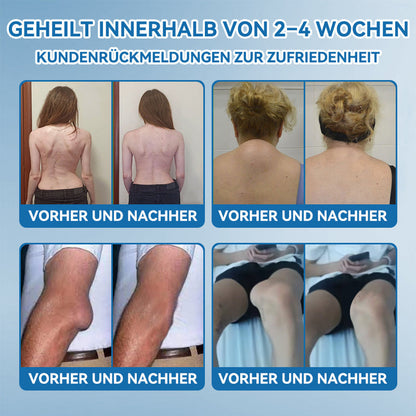 𝖯𝗂𝖼𝗱𝗼®🍁💖 BPC-157 Gelenkheilcreme🦴Behandelt Arthritis, Neuropathie, Rheuma, Sportverletzungen & mehr👍