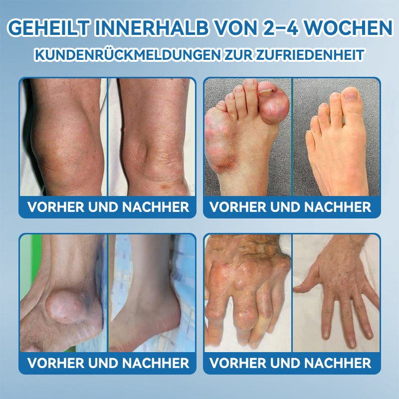 𝖯𝗂𝖼𝗱𝗼®🍁💖 BPC-157 Gelenkheilcreme🦴Behandelt Arthritis, Neuropathie, Rheuma, Sportverletzungen & mehr👍