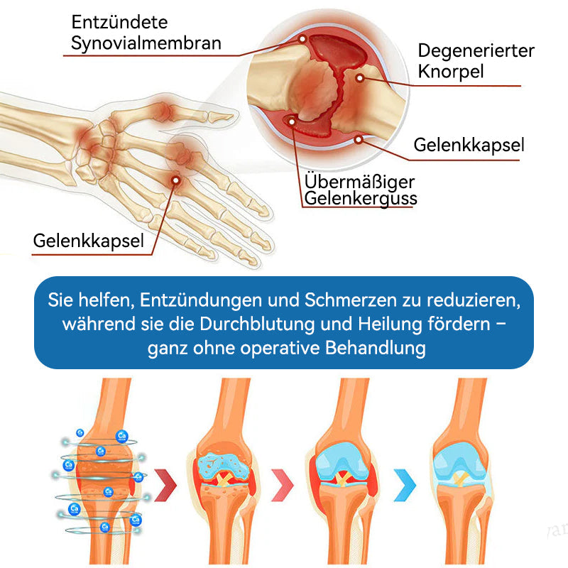 𝖯𝗂𝖼𝗱𝗼®🍁💖 BPC-157 Gelenkheilcreme🦴Behandelt Arthritis, Neuropathie, Rheuma, Sportverletzungen & mehr👍