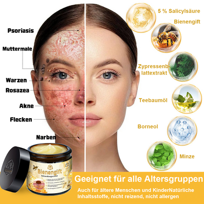 [Zusätzliche 50 % Rabatt] TLOPA® Fortgeschrittene Bienengift Behandlungscreme