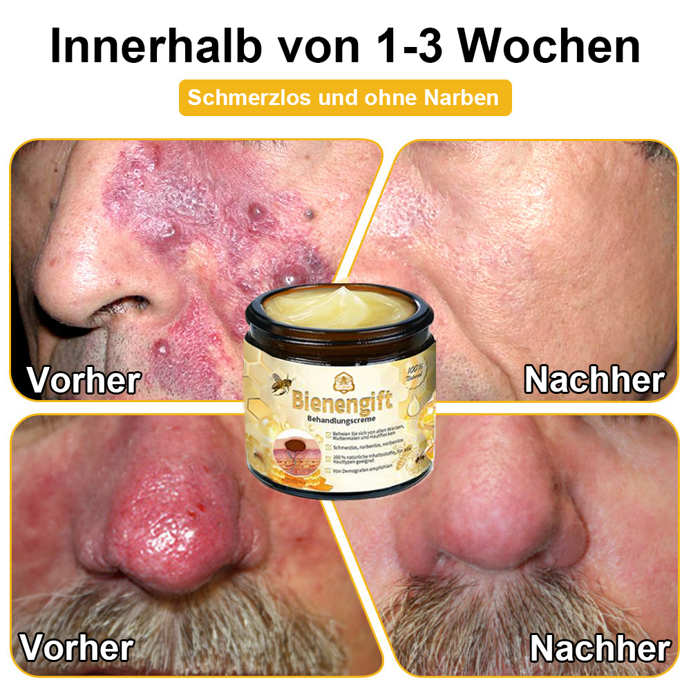 [Zusätzliche 50 % Rabatt] TLOPA® Fortgeschrittene Bienengift Behandlungscreme