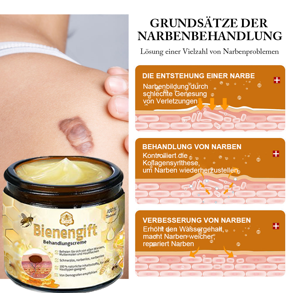[Zusätzliche 50 % Rabatt] TLOPA® Fortgeschrittene Bienengift Behandlungscreme