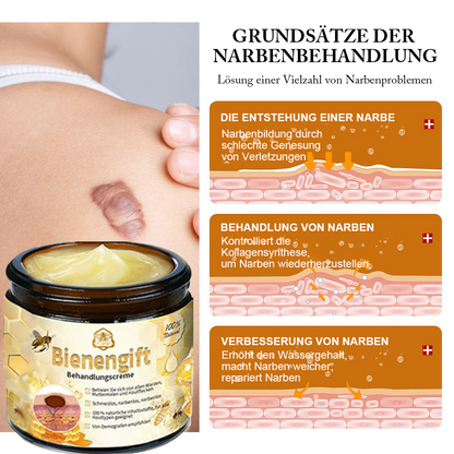 [Zusätzliche 50 % Rabatt] TLOPA® Fortgeschrittene Bienengift Behandlungscreme
