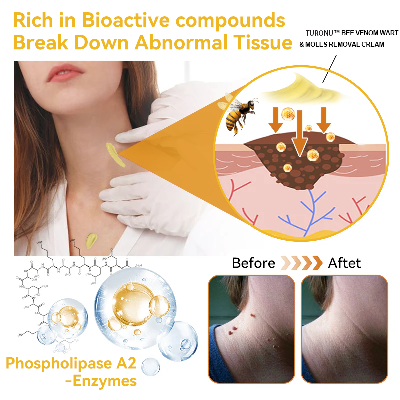 [Zusätzliche 50 % Rabatt] TLOPA® Fortgeschrittene Bienengift Behandlungscreme