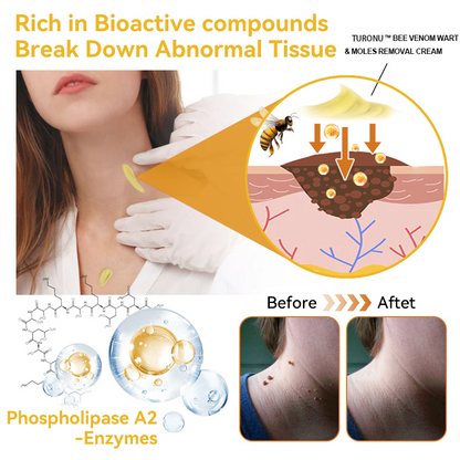 [Zusätzliche 50 % Rabatt] TLOPA® Fortgeschrittene Bienengift Behandlungscreme