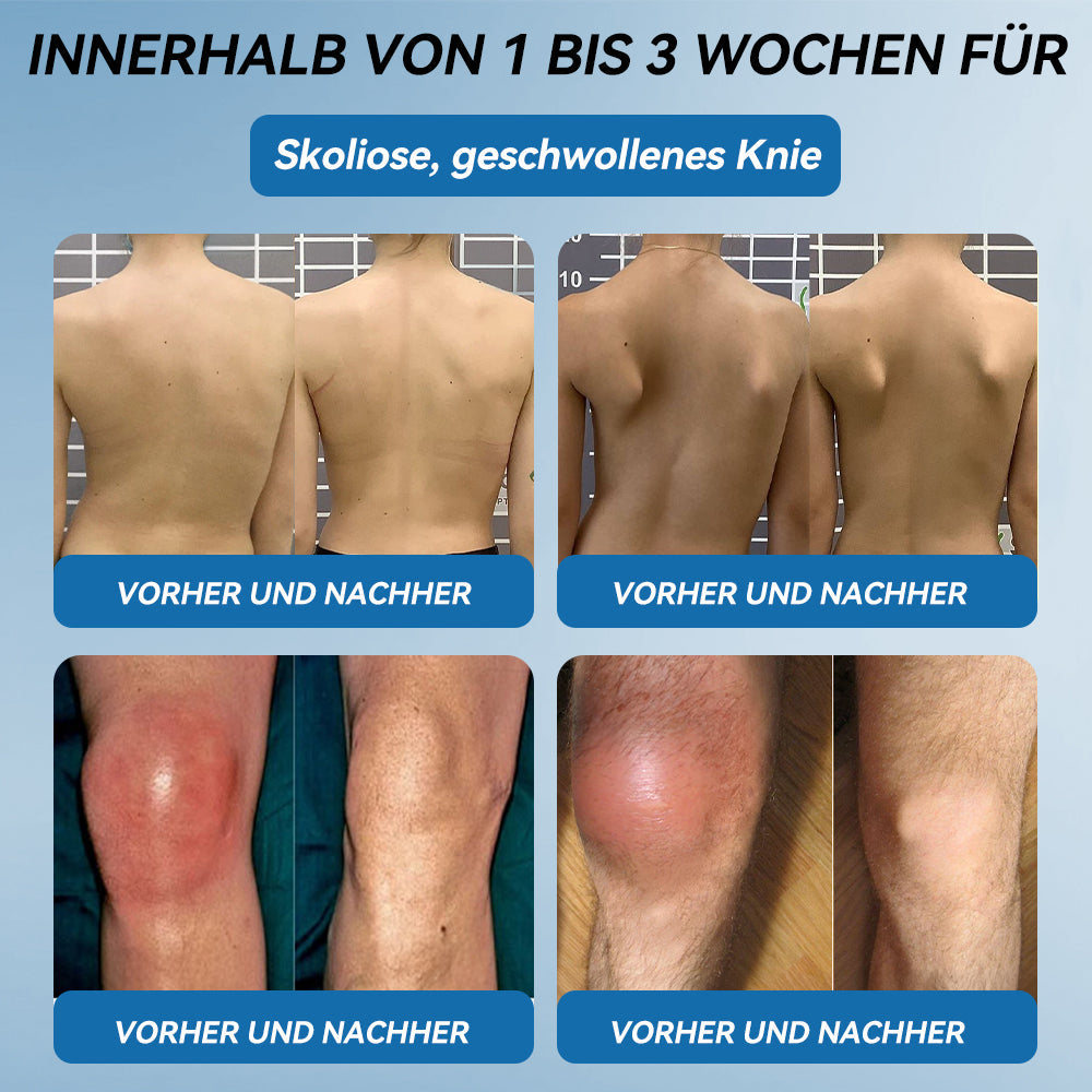 𝖯𝗂𝖼𝗱𝗼®🍁💖 BPC-157 Gelenkheilcreme🦴Behandelt Arthritis, Neuropathie, Rheuma, Sportverletzungen & mehr👍