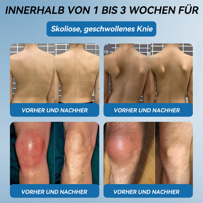 𝖯𝗂𝖼𝗱𝗼®🍁💖 BPC-157 Gelenkheilcreme🦴Behandelt Arthritis, Neuropathie, Rheuma, Sportverletzungen & mehr👍