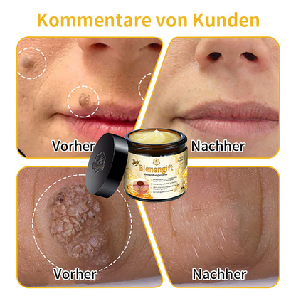 [Zusätzliche 50 % Rabatt] TLOPA® Fortgeschrittene Bienengift Behandlungscreme