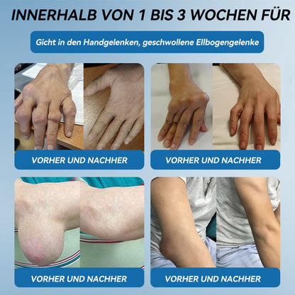 𝖯𝗂𝖼𝗱𝗼®🍁💖 BPC-157 Gelenkheilcreme🦴Behandelt Arthritis, Neuropathie, Rheuma, Sportverletzungen & mehr👍