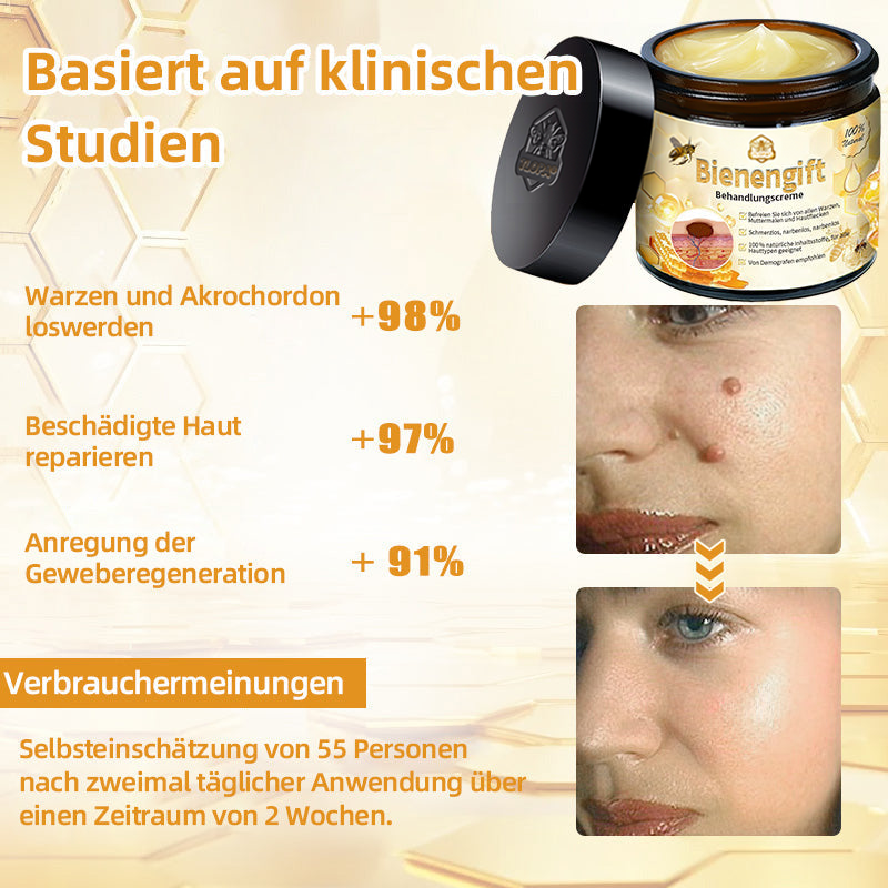 [Zusätzliche 50 % Rabatt] TLOPA® Fortgeschrittene Bienengift Behandlungscreme