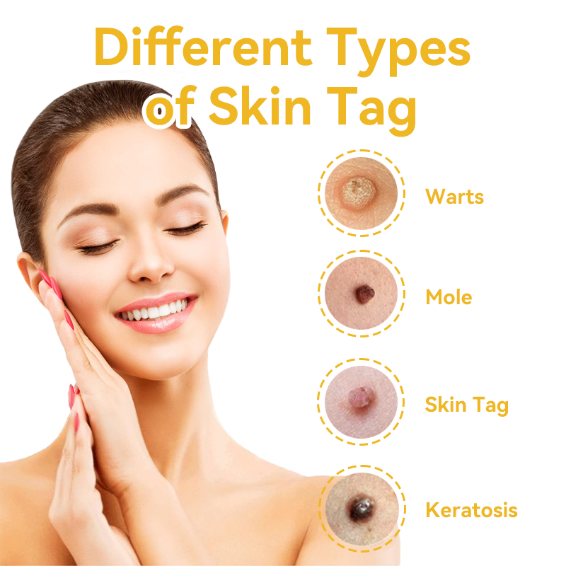 [Zusätzliche 50 % Rabatt] TLOPA® Fortgeschrittene Bienengift Behandlungscreme