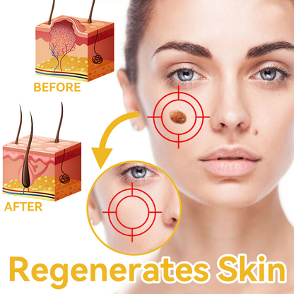 [Zusätzliche 50 % Rabatt] TLOPA® Fortgeschrittene Bienengift Behandlungscreme